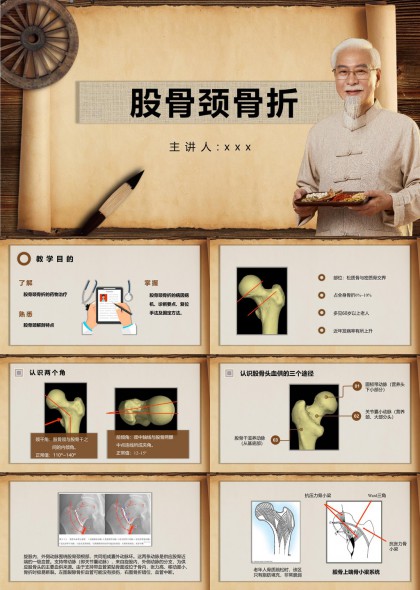 股骨颈骨折医学讲解PPT模板