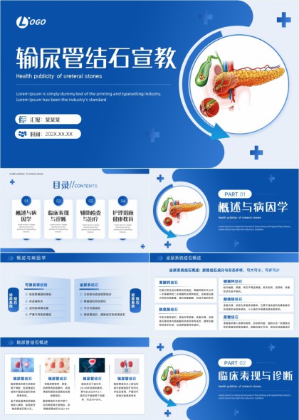 输尿管结石健康宣教医学科普PPT模板