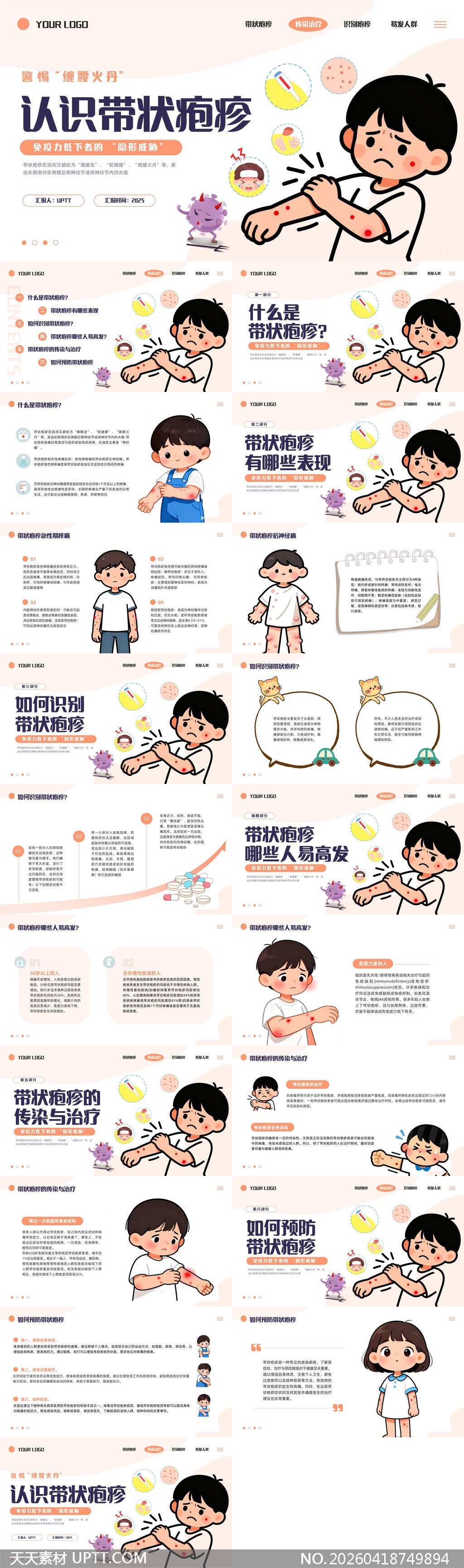 带状疱疹医学科普健康教育PPT模板-天天素材库PPT模板