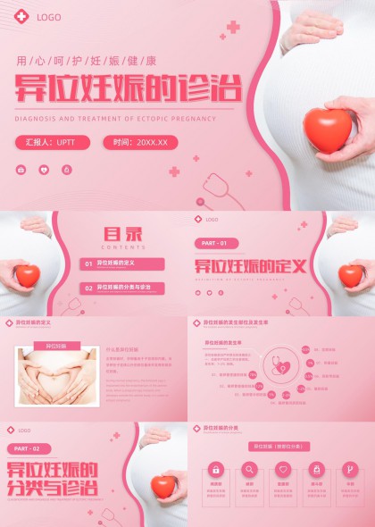 异位妊娠诊断与治疗全流程讲解PPT模板